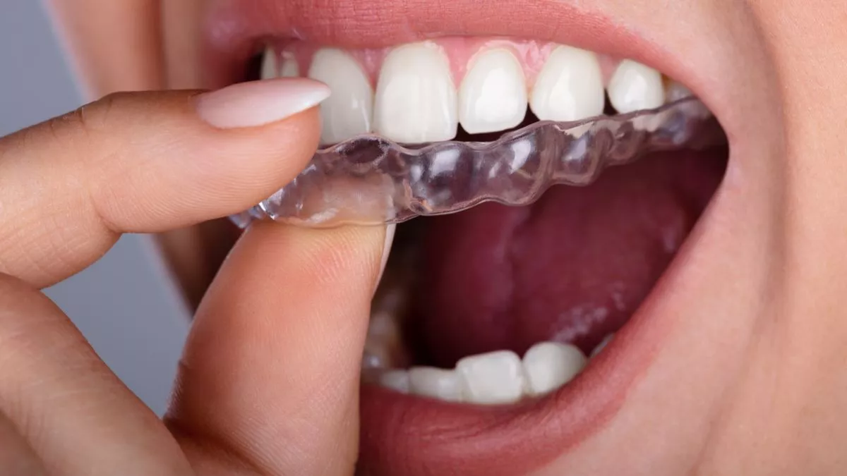 Alinea tus dientes con ortodoncia invisible