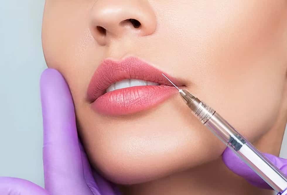 Ácido hialurónico en labios: costos y riesgos