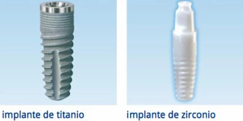 Diferencias entre implantes dentales de titanio y zirconio